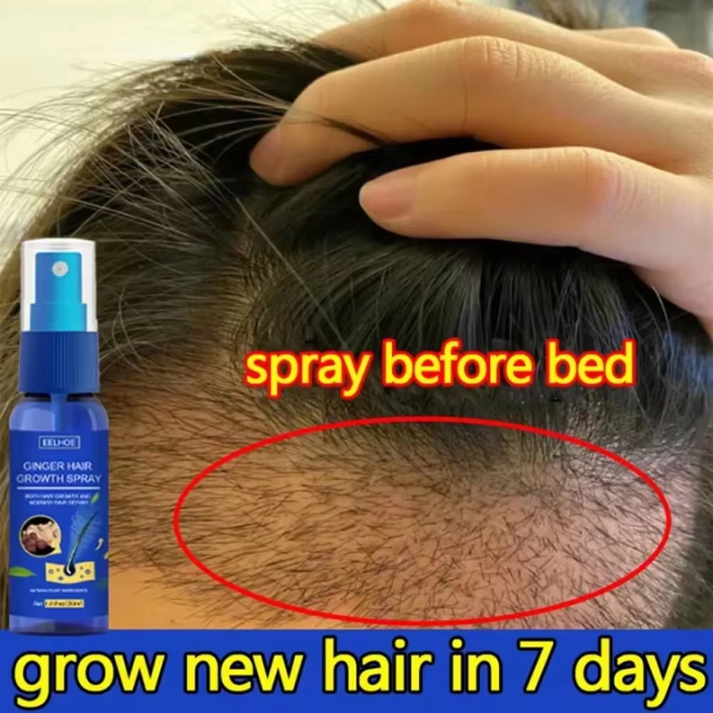 Hair Care Natural - 빠른 생강 모발 성장 스프레이, 모발